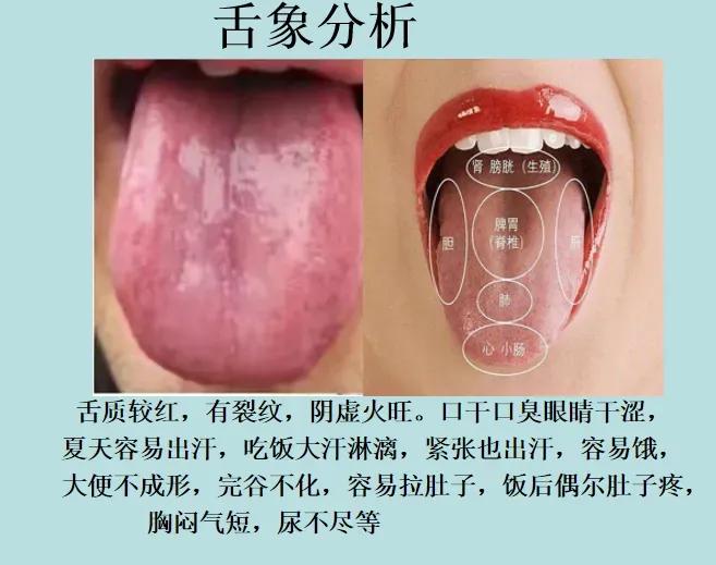 舌头是健康的晴雨表，今天就来给大家科普一下临床常见的6种舌象，让我们一起来学习舌