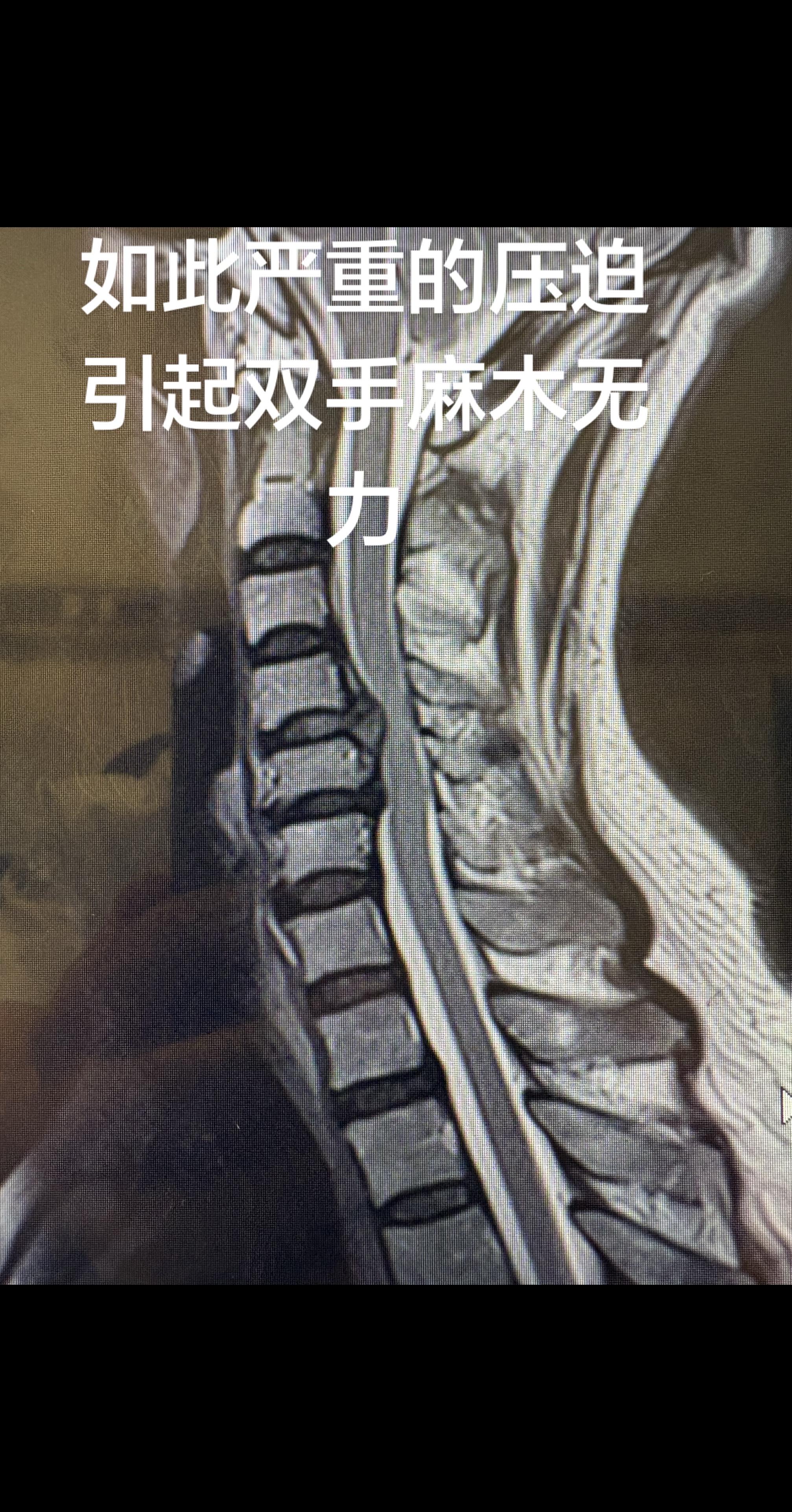医治有缘人。病人问我能不能吃药？我说没有意义，还是得尽快手术。病人和家...