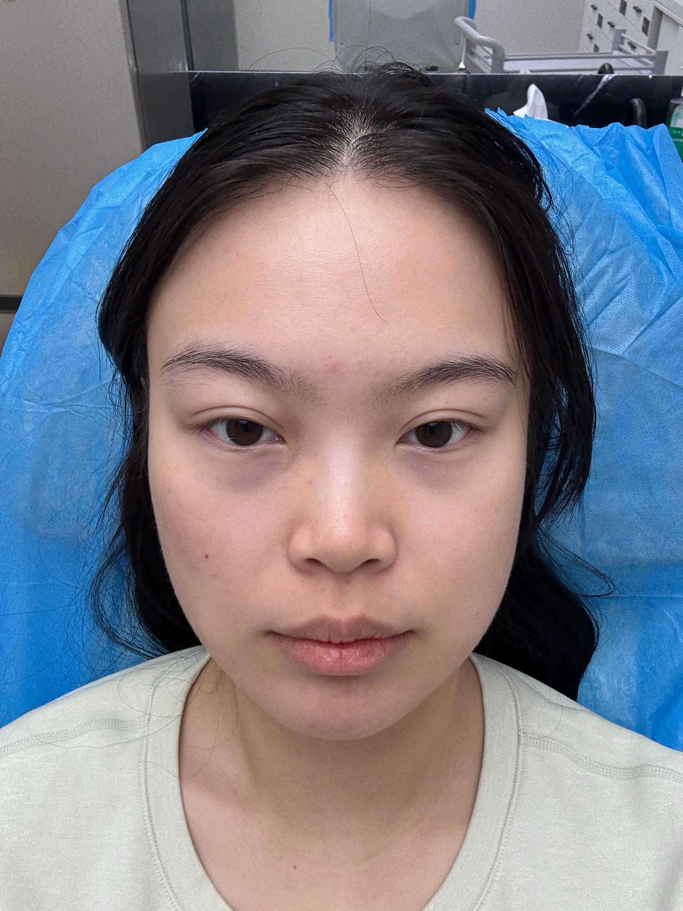 前后 感觉好点。感觉饱满点了。不然疲惫感很重啊。 