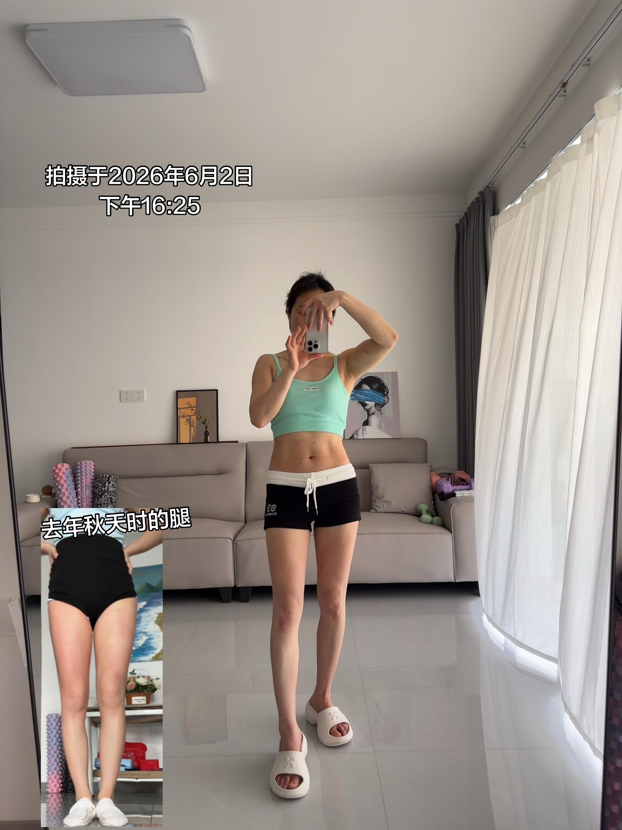 一定要运动练腿才可以细腿吗？不练腿也可以细腿 下半身粗 上半身纸片人了...