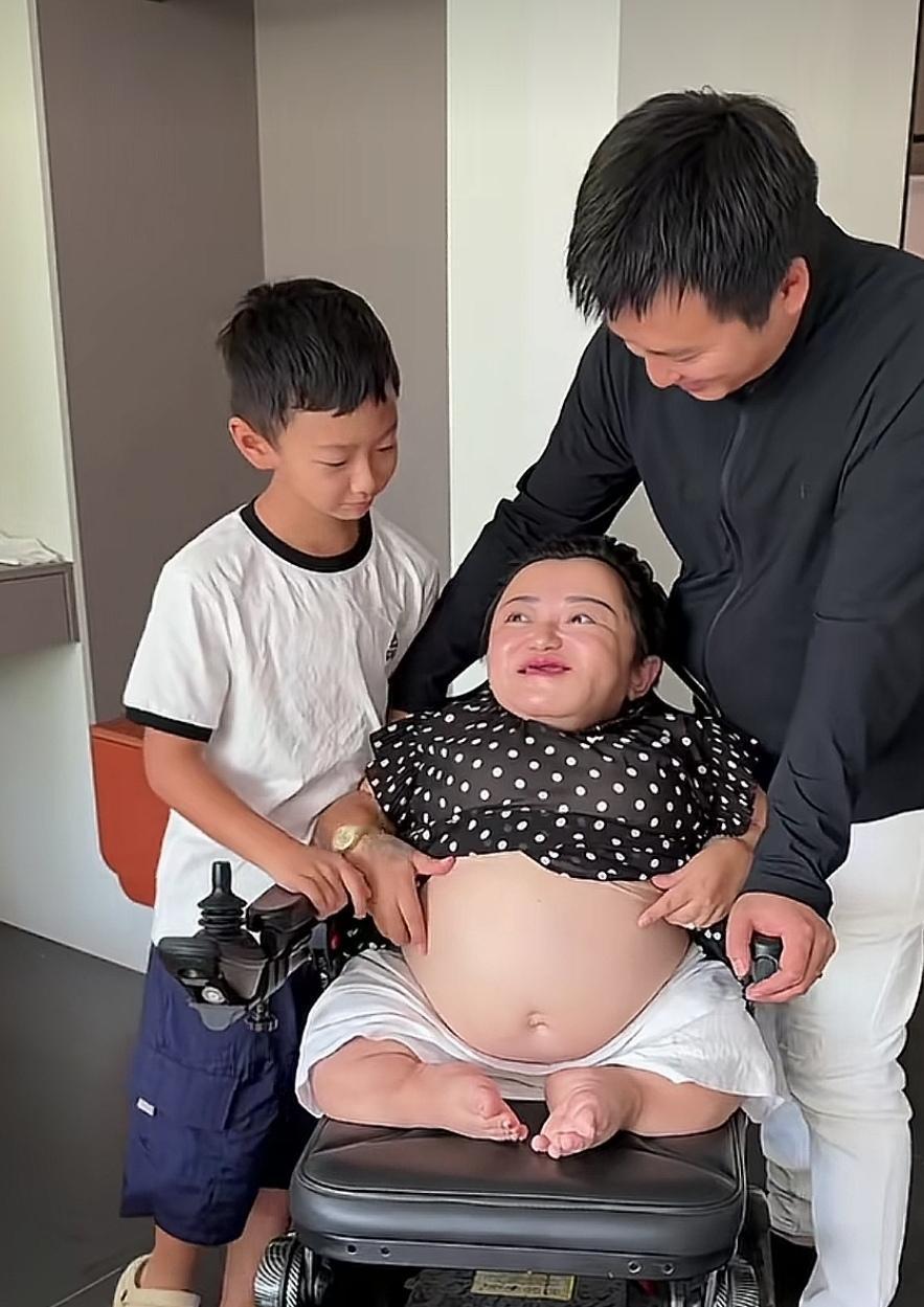 有人说：喜梅用老命换小命对不对？
     喜梅是残疾人中励志的代表，也是大网红