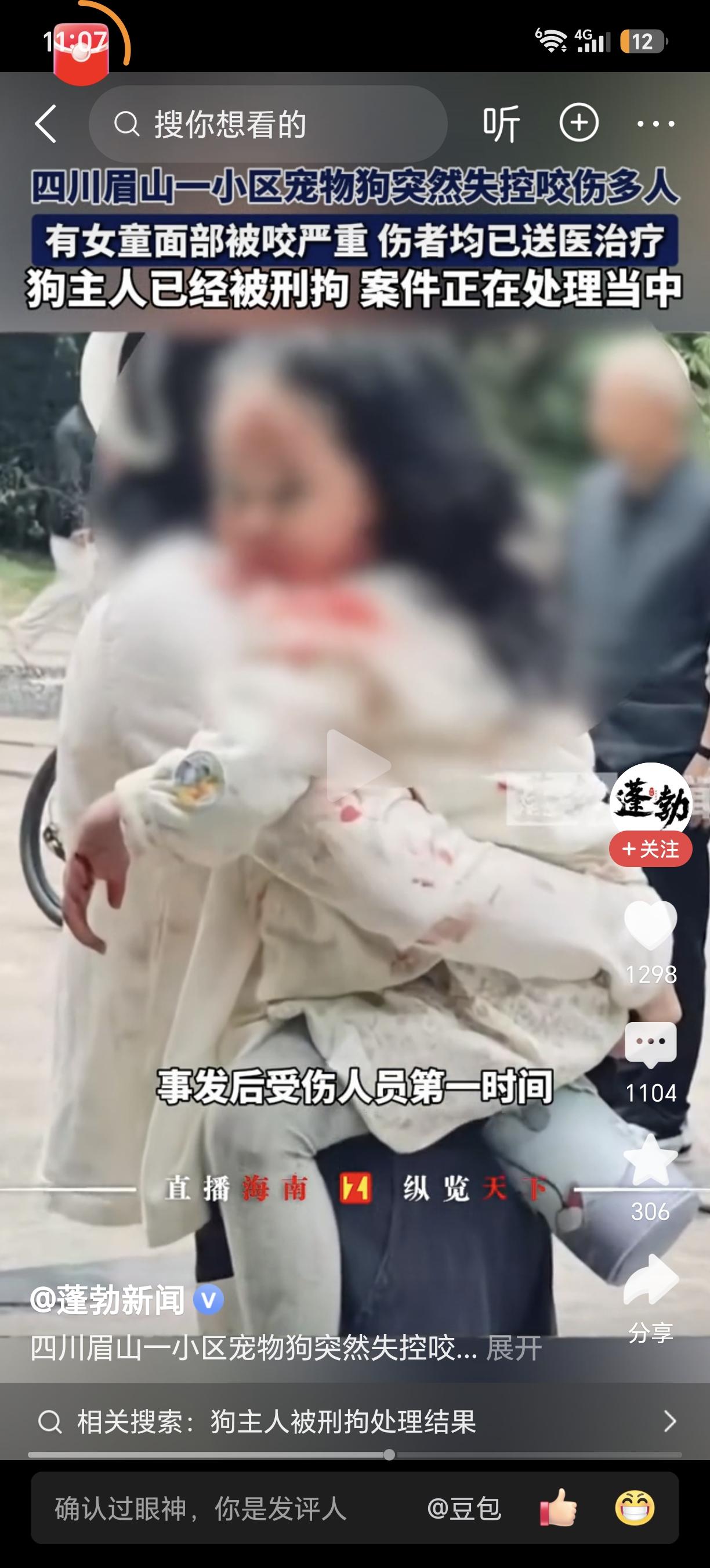 太让人恐惧了！恶狗咬人如何破？近日，四川眉山仁寿县中城国际社区，一个牛头梗一下子