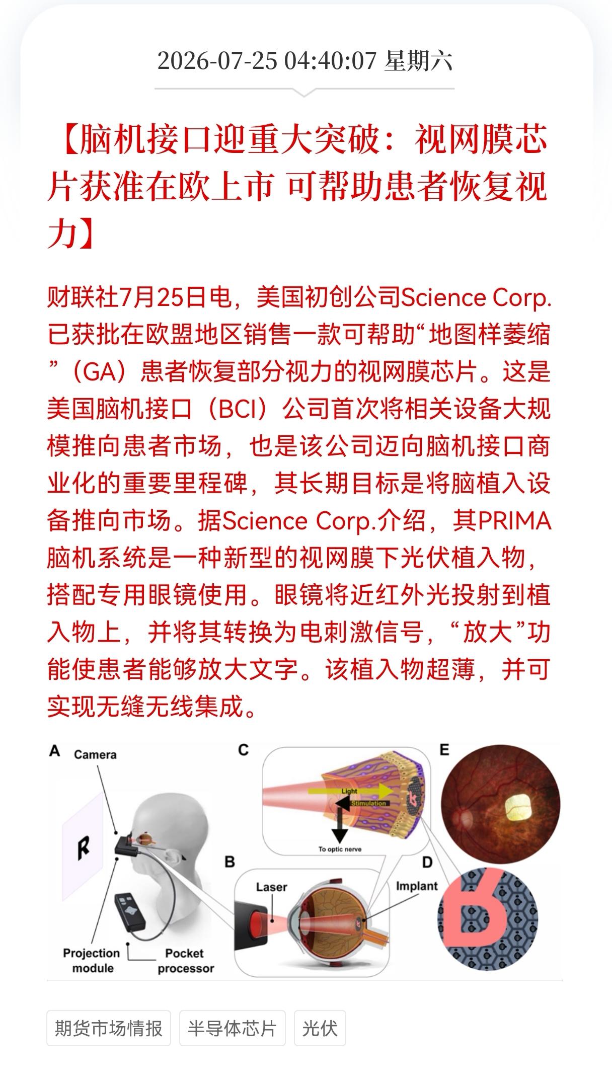 好消息！重大好消息！
脑机接口发布重大利好消息！
脑机接口迎重大突破：视网膜芯片