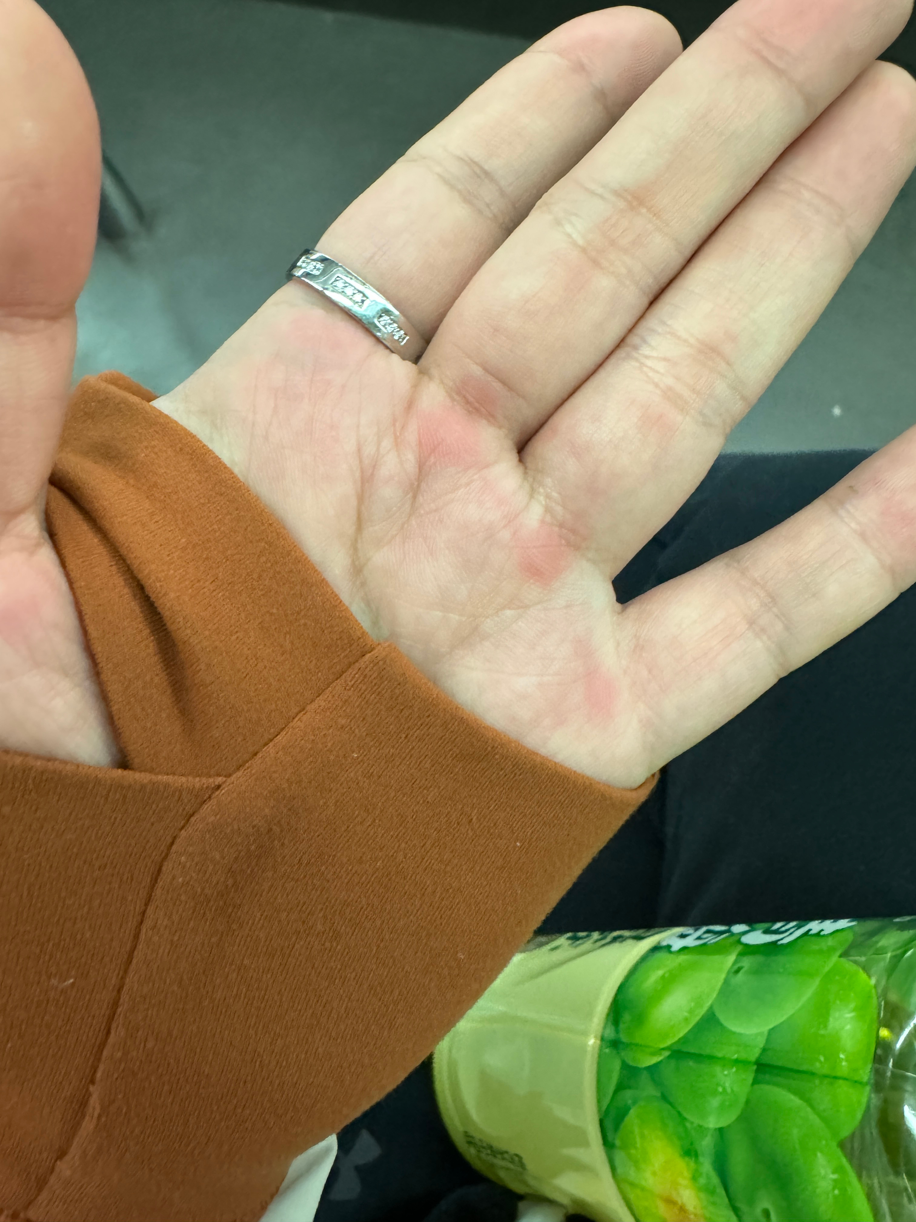 胳膊疼，巨疼，复健以来昨天头回练背……代偿肌酸死[单身狗]手疼啊 ​​​