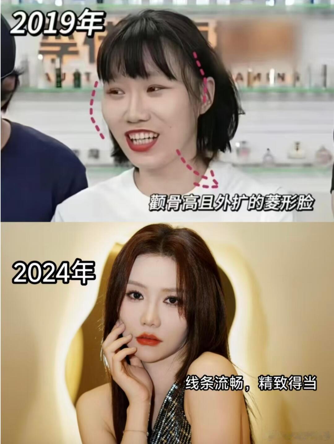 旺旺爆改 凸嘴高颧骨变美天花板旺旺，不服来辩❗旺旺，可以说是“凸嘴高颧变美”to