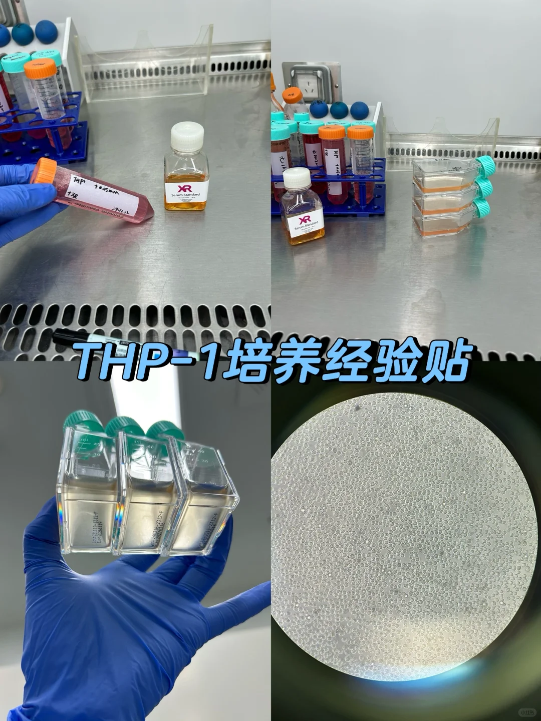 经验贴/如何养好THP-1细胞❓