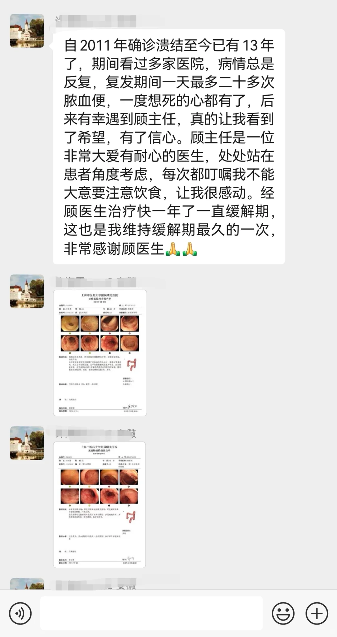 维多珠无效的全结肠重症溃结患者接近缓解