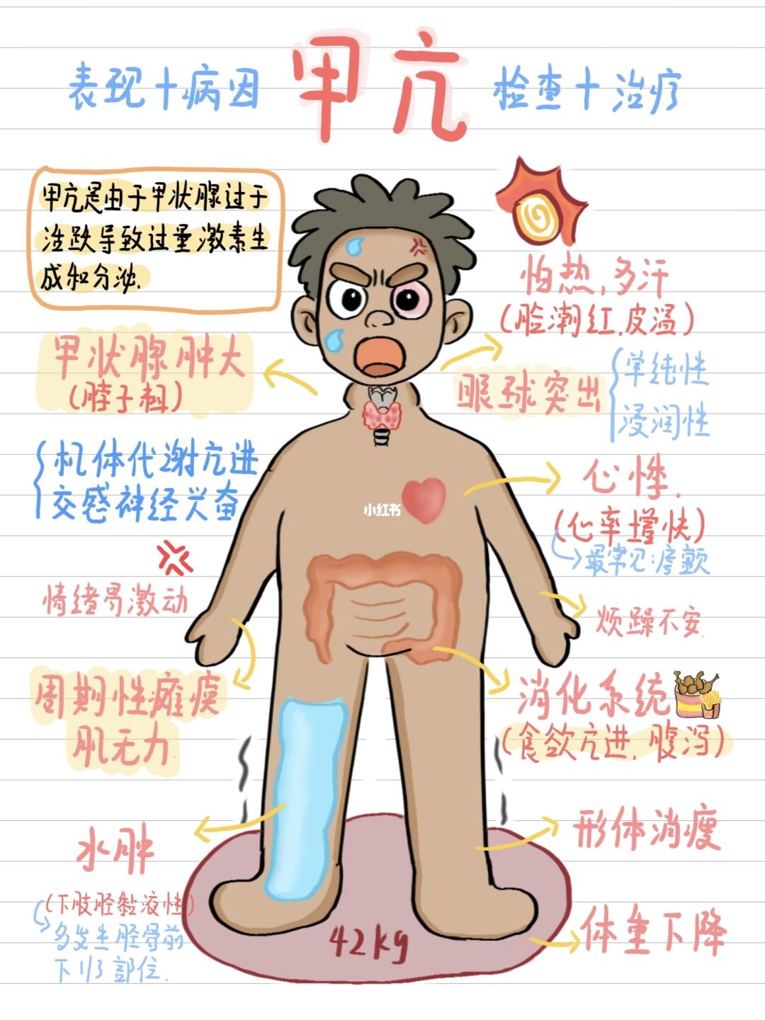 医学生笔记📚-甲亢