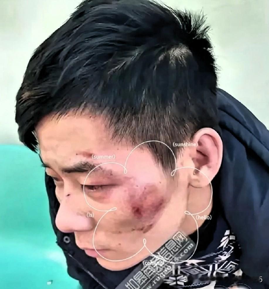 5月10号大半夜，一男的被六个人死命追打。换作一般人早抱头挨揍了，但这老哥堪称教