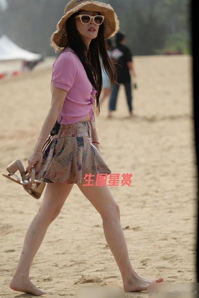 张碧晨这图已经生得不能再生了，这一腿的蚊子包啊，把蚊子喂饱了 