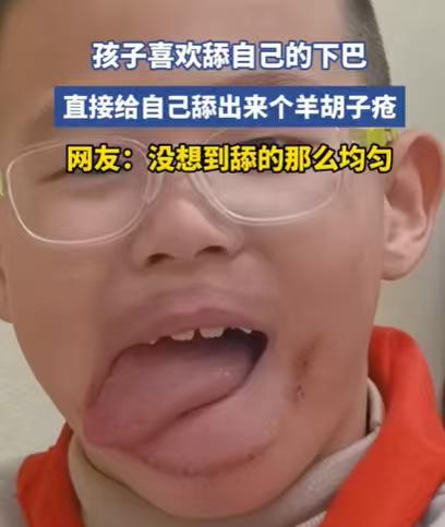 如果你家里的孩子每天喜欢舔舔自己的下巴，一定要制止。

别看这只是一个小习惯，舔