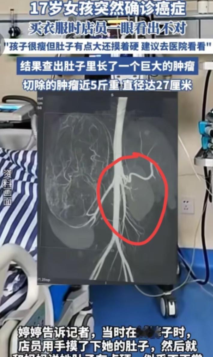 2025年6月，广东17岁女孩和妈妈一起逛街买衣服，在试裤子的时候，老板娘发觉女