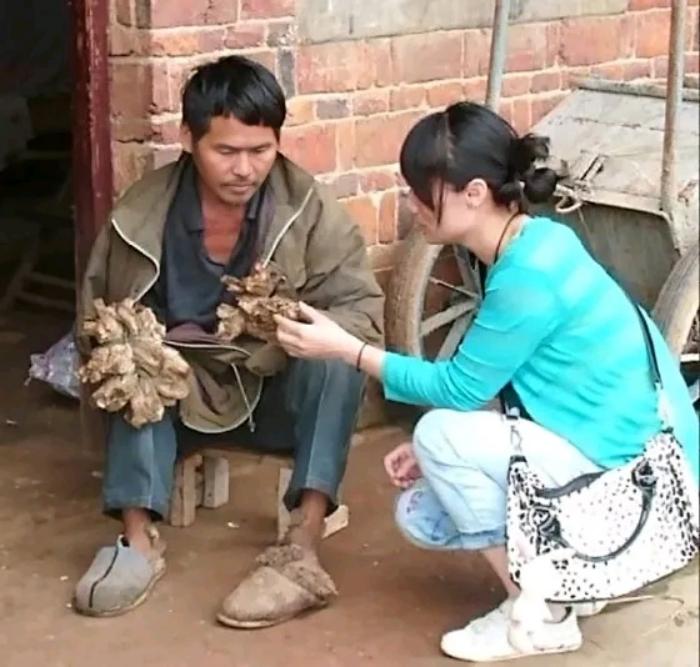西游记里的树人照进现实！
 
湖南一小伙子双手长满了密密麻麻的“树枝”，这些树枝