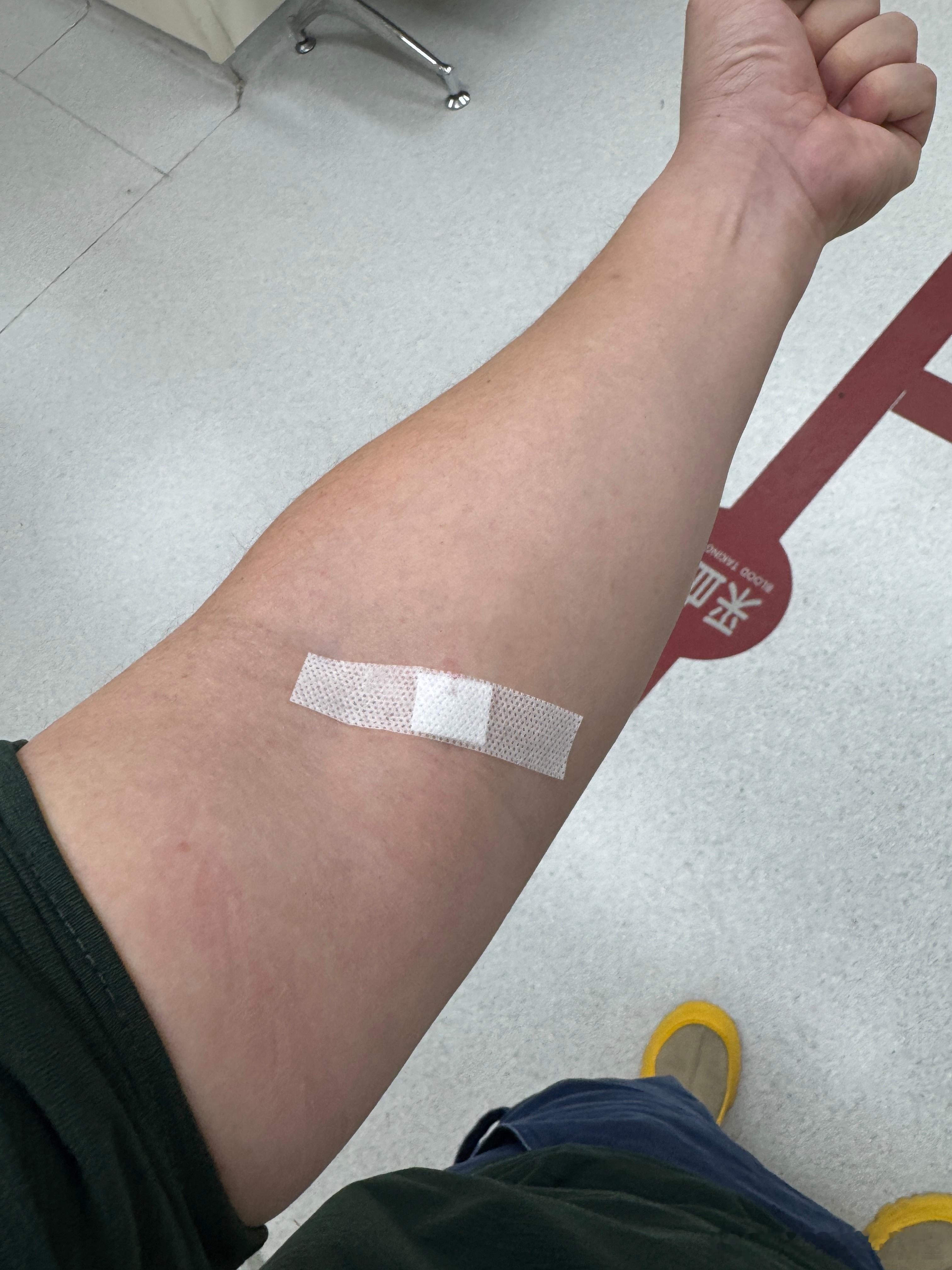 休息日发个烧，一点不浪费，有没有和我一样晕针的，抽血能吓死我 