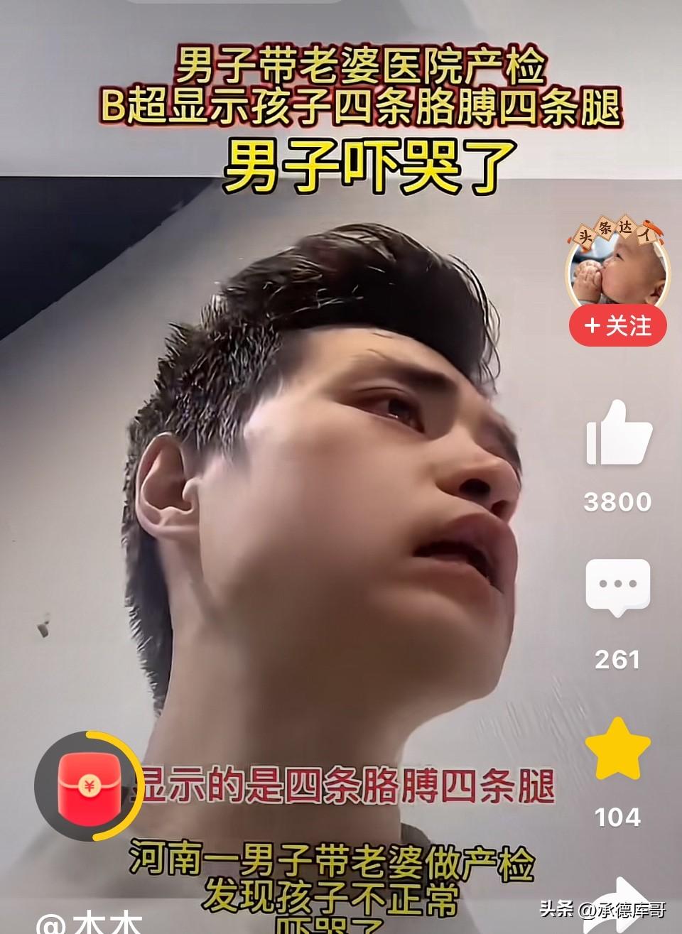 丈夫陪妻子产检，医生说胎儿四条胳膊四条腿，丈夫当场吓哭！医生一句话让他破涕为笑！