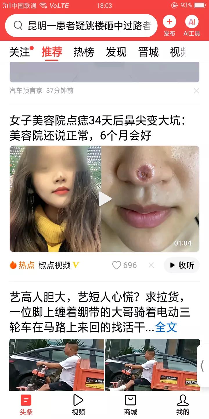 美女鼻子上长了一颗痣，去美容院点了后变成一颗大坑，彻底毁容了，她去讨要说法，美容