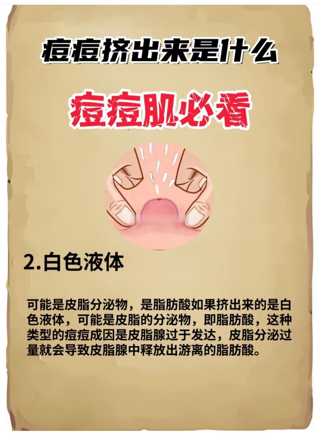 关于挤痘痘你需要知道的 