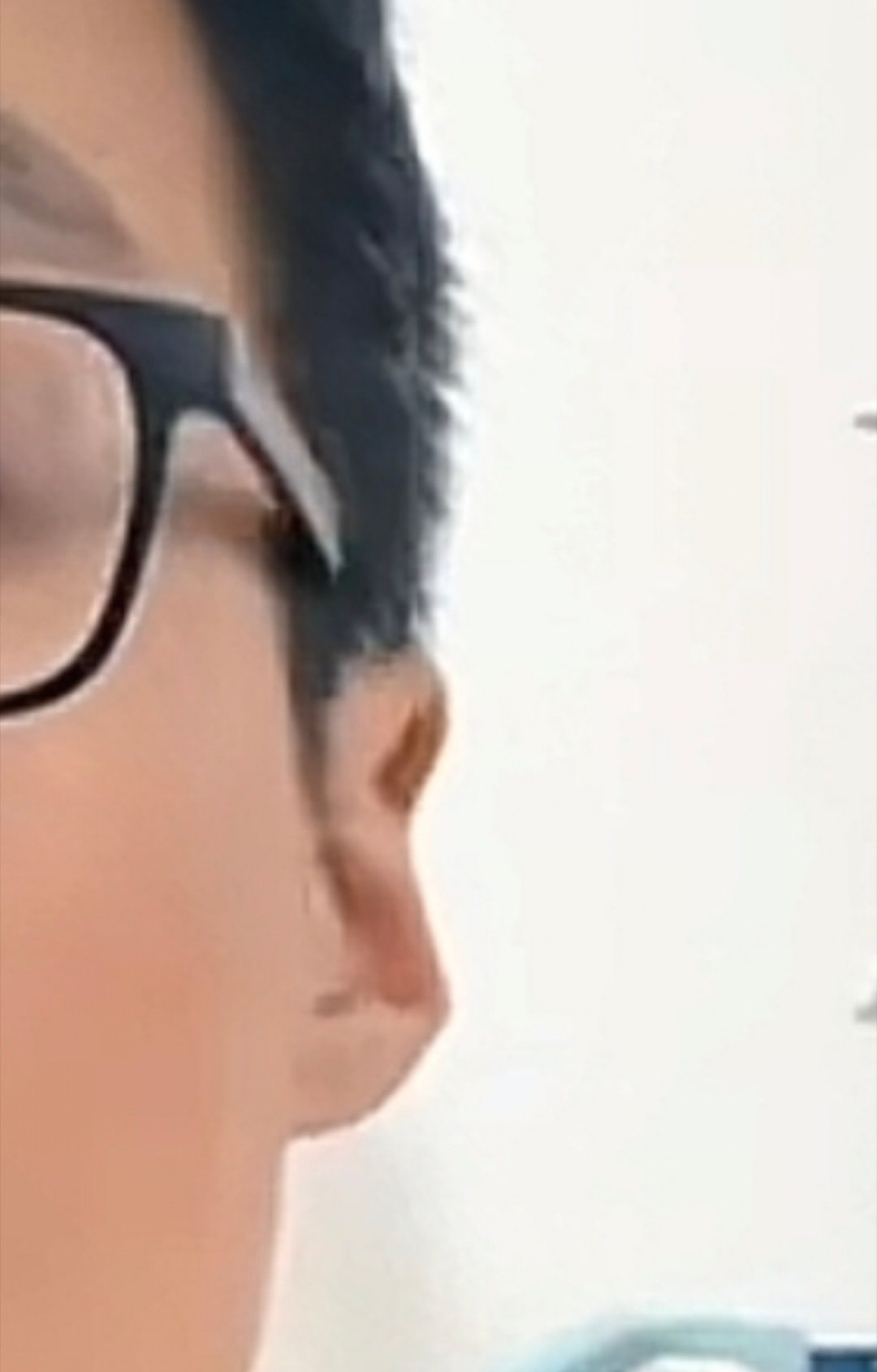 这种耳相很少优质男，出渣男概率很高。渣女概率也不低。人生之路波折坎坷多，福气少。