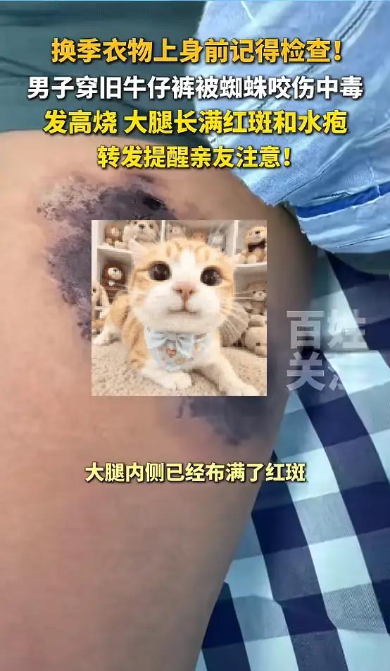 “吓得我差点腿软！”杭州的陈先生最近经历了一场“牛仔裤里的惊魂记”——本来只是随