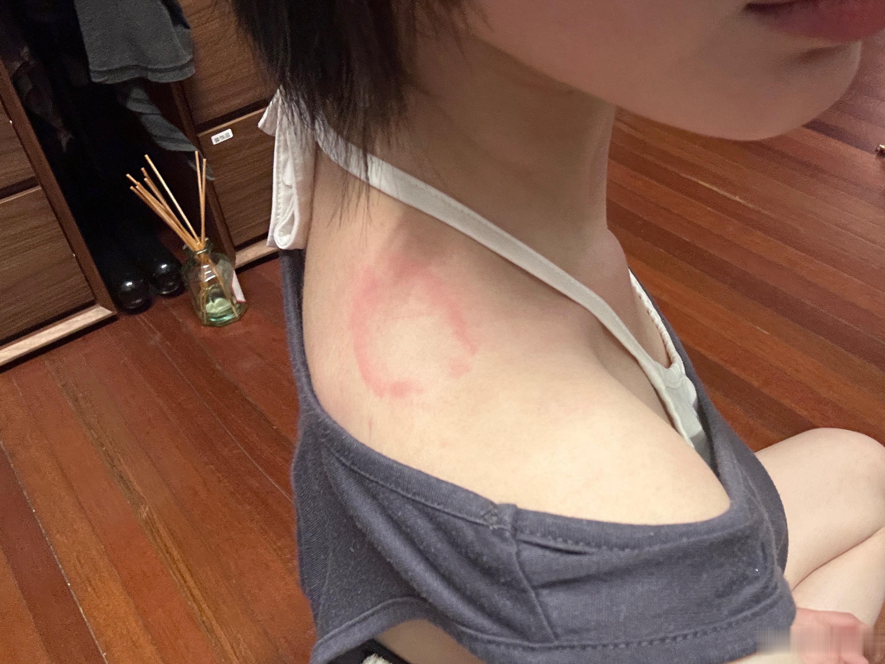整天被木青咬，她牙跟金刚石做的一样 