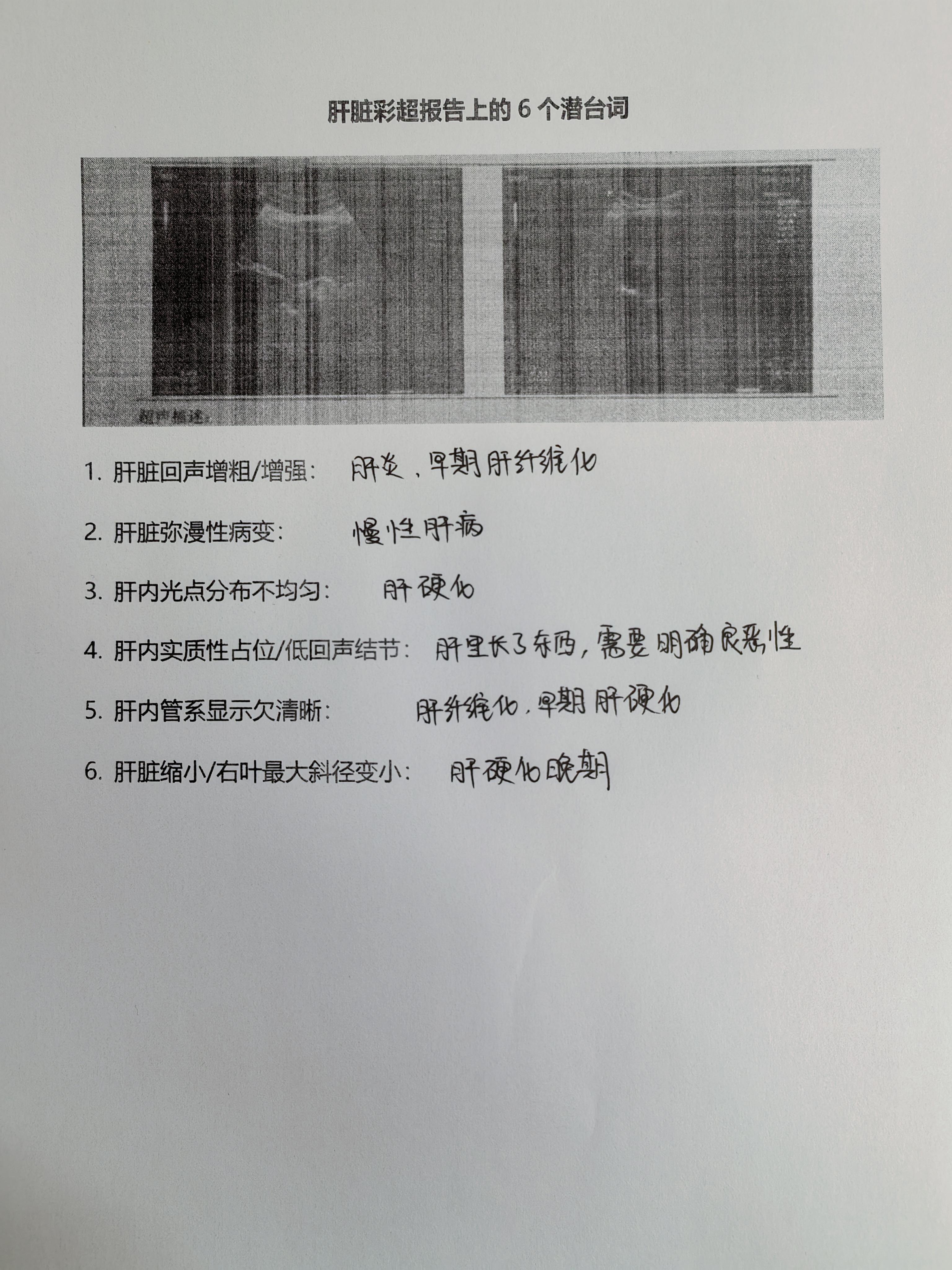 乙肝 肝炎 肝硬化 医学科普