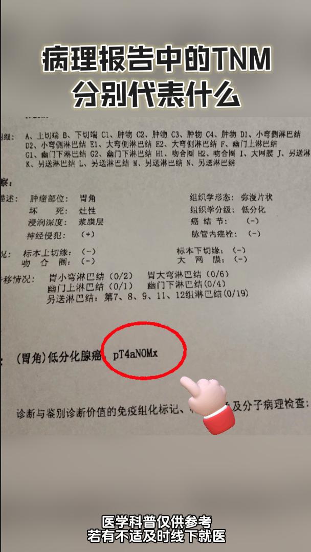 癌症病理报告中的TNM分别代表着什么。一次性弄清楚: TNM分期系统是...