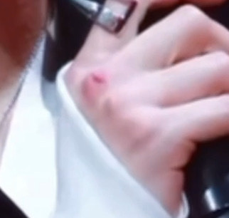 我去 朱志鑫手因为荣耀之战的道具受伤了朱志鑫手受伤