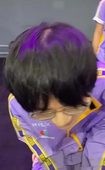 🔴坦然的发缝自由了😂王者荣耀KPL2026KPL夏季赛