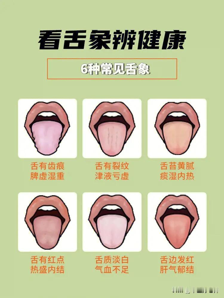 看舌象，知健康，看看你是哪一种？#健康##舌象#
