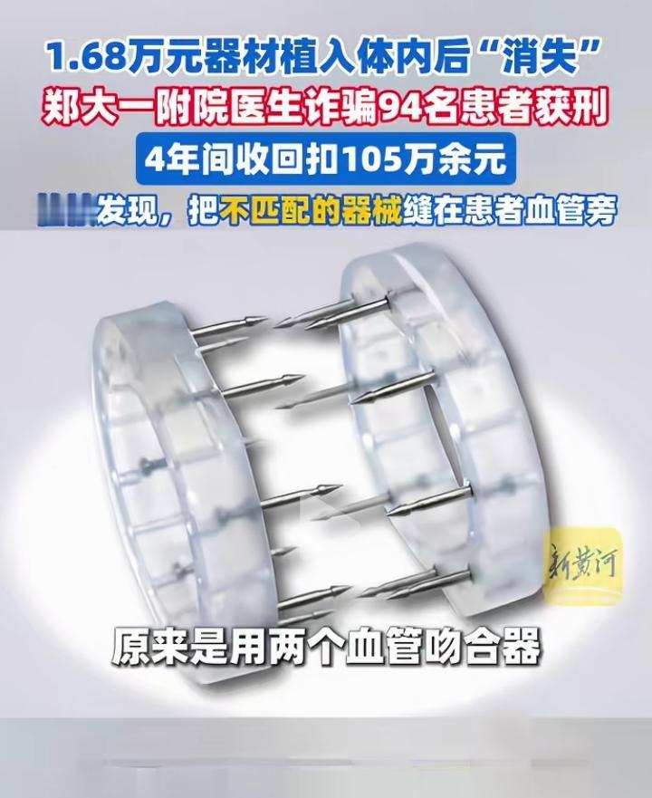 一患者在郑州一医院花1.68万元买的器材植入体内后神奇消失。事实是钱花了，医生根
