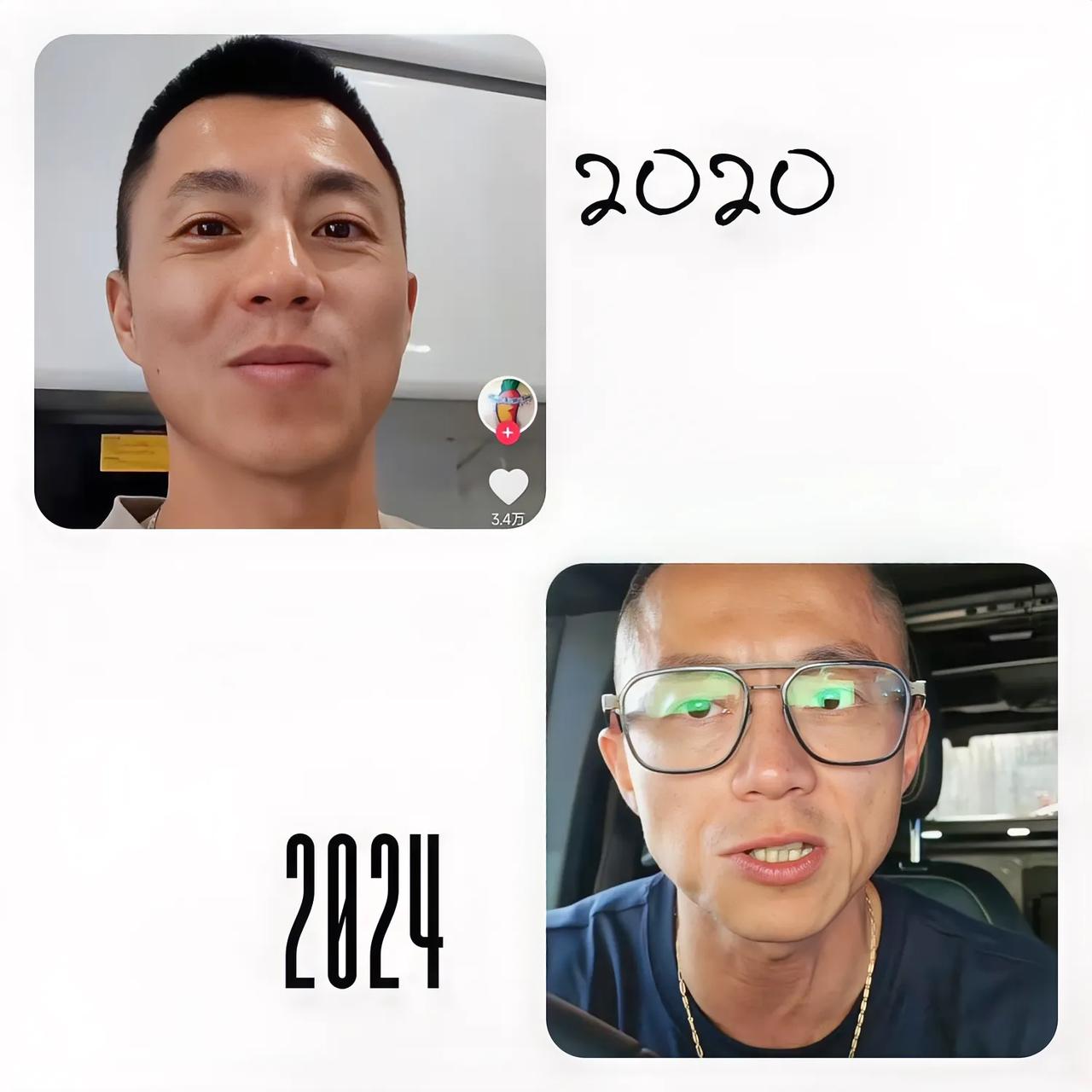陈震这4年看着小脸不滑嫩了，皮肤也松弛了，不全是生酮饮食所致的吧，运动过量也会让