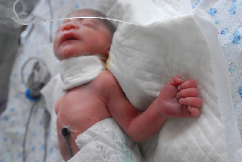 3月4日，吉林一63岁产妇顺利诞下女婴，此前35岁独子因肿瘤离世，“这个孩子出生