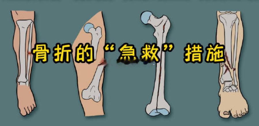 一场大雪，说是积水潭医院当天就接了170例摔伤患者，几乎都是骨折~~~各位要注意