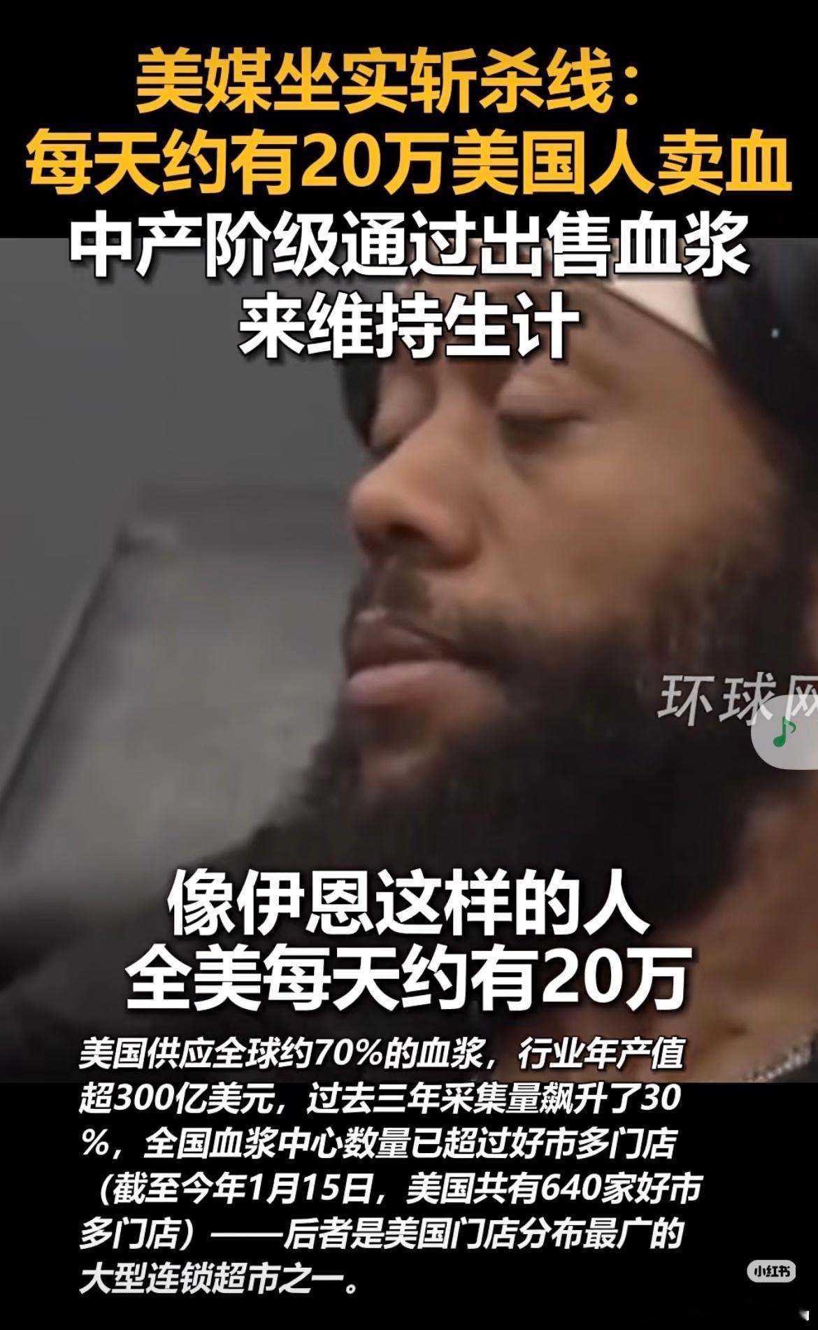 每天20万美国人卖血维生美媒证明每天有约20万美国人为了生计去卖血，而且还是中产