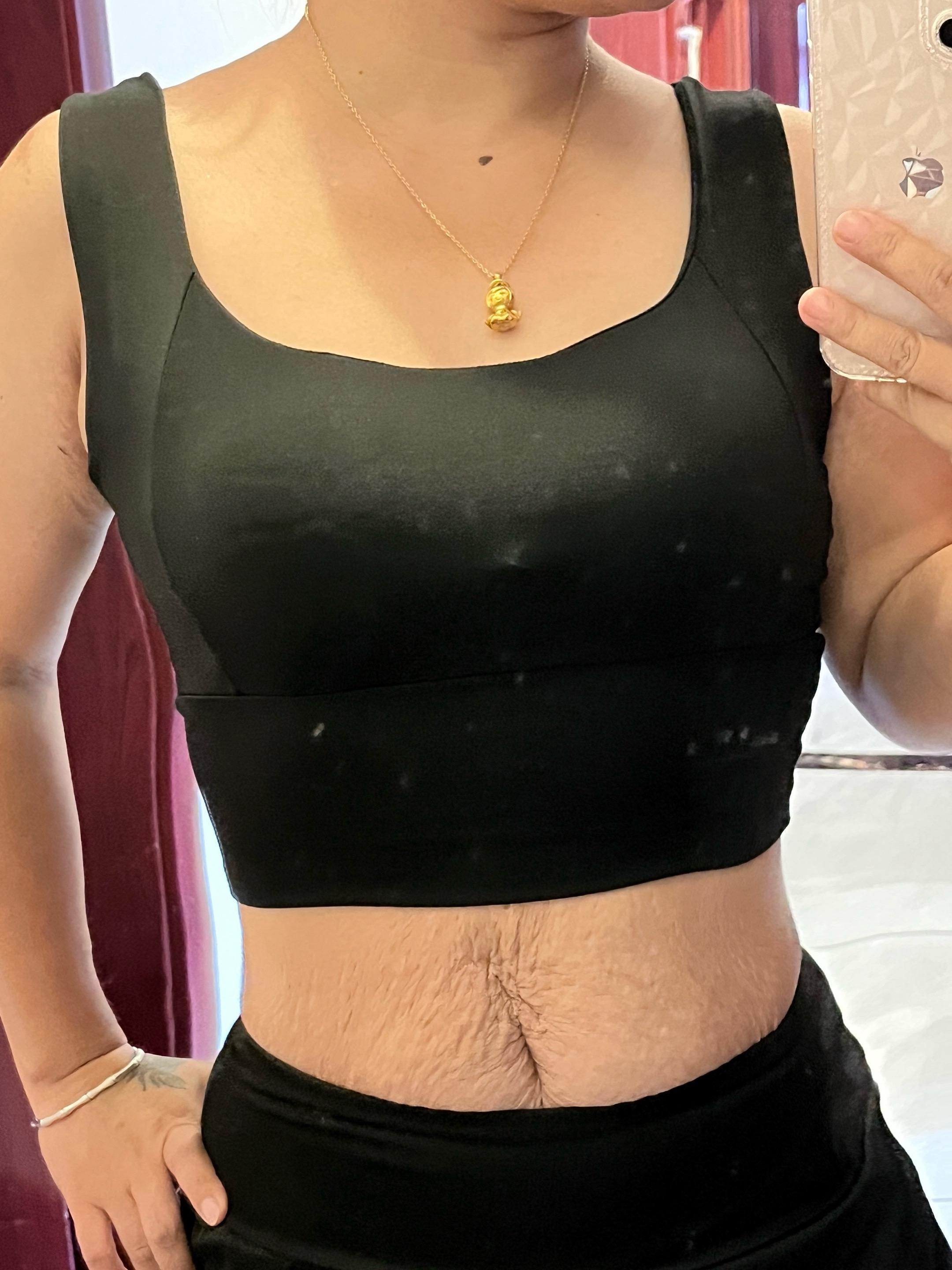 妊娠纹并不可怕，自卑才是无底洞，因为我们的好看并不是由它决定的，加油，辣妈们