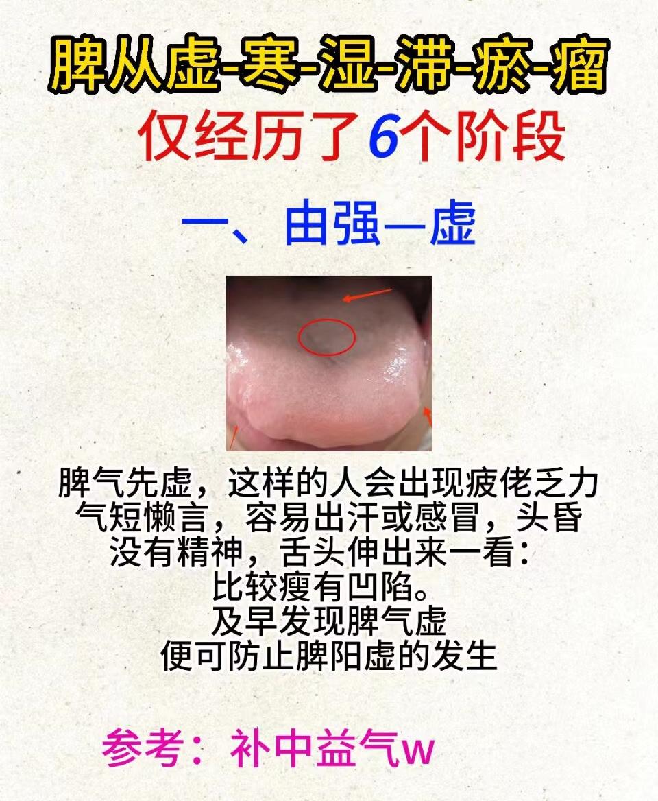 脾从虚—寒—湿—滞—瘀—瘤
仅仅经历了6个阶段，看看以下图片，你到哪一个阶段了？