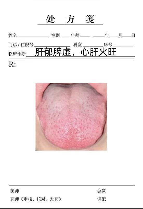 今天我们继续来分析粉丝发来的舌像。

第一个舌头鼓胀，舌边有气滞点，那么舌苔厚腻