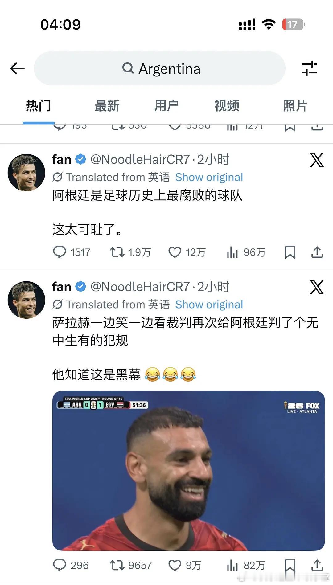 阿根廷 脏内外网同时热趋第一 
