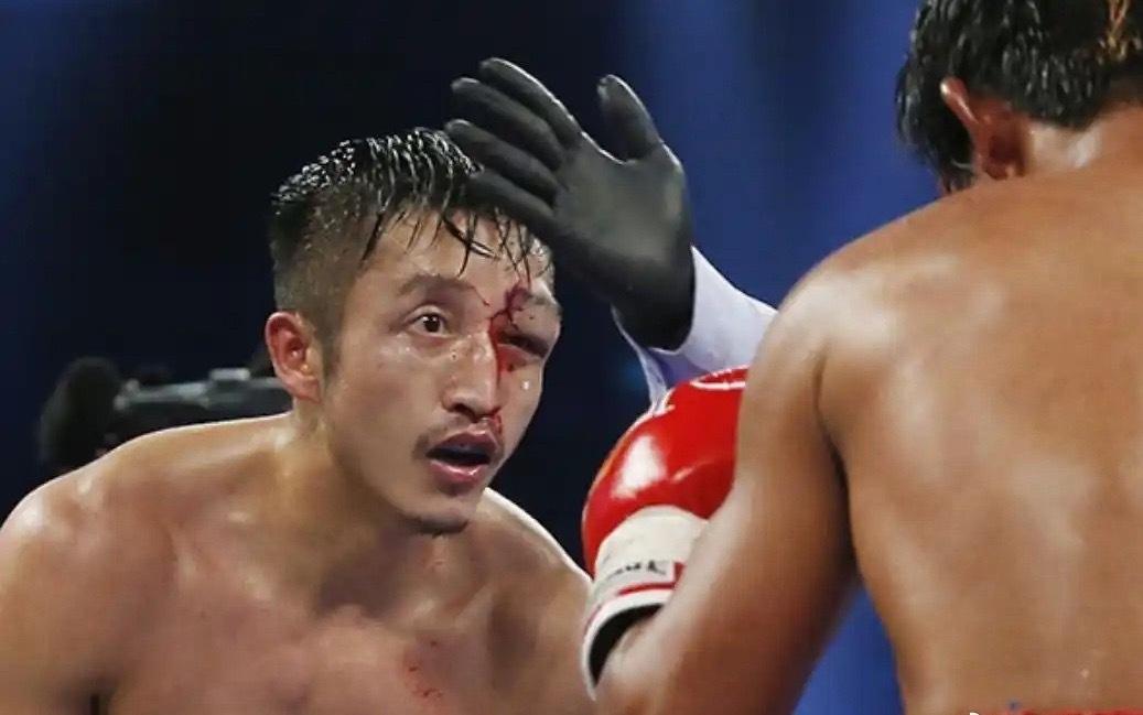 太心酸了！拳王邹市明45岁还要复出打拳！
主要是投资失败亏了两个亿！
这庭花销太