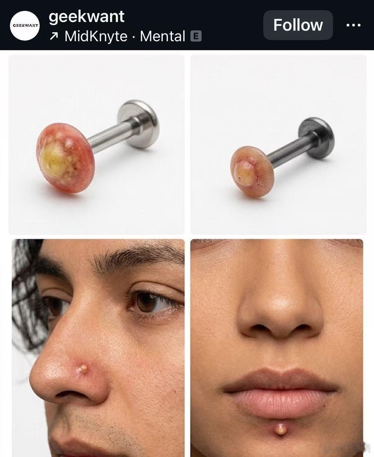 把痘痘做成耳钉是懂恶心人的... 