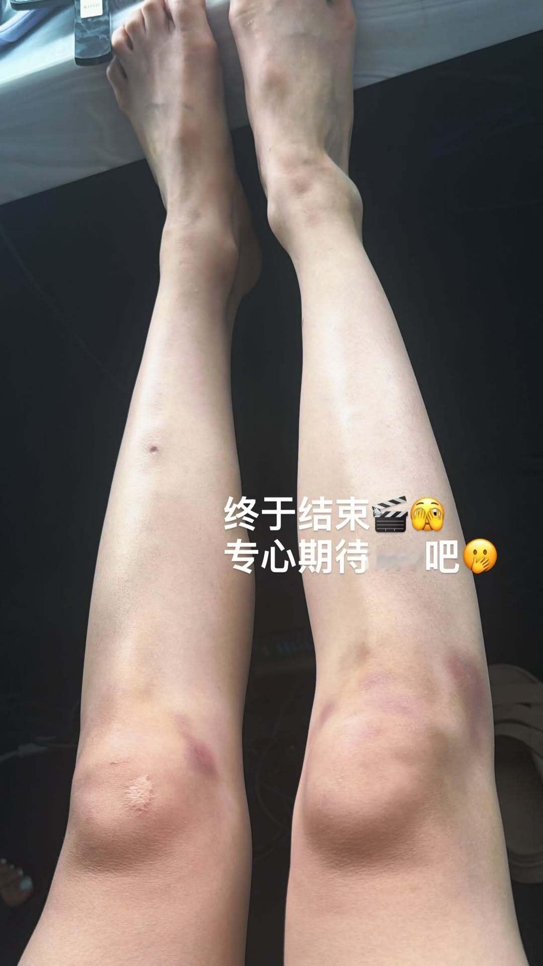 idle组合宋雨琦烟嗓妖精❤️帅气北京狗勾260815 雨琦ig快拍更新 
