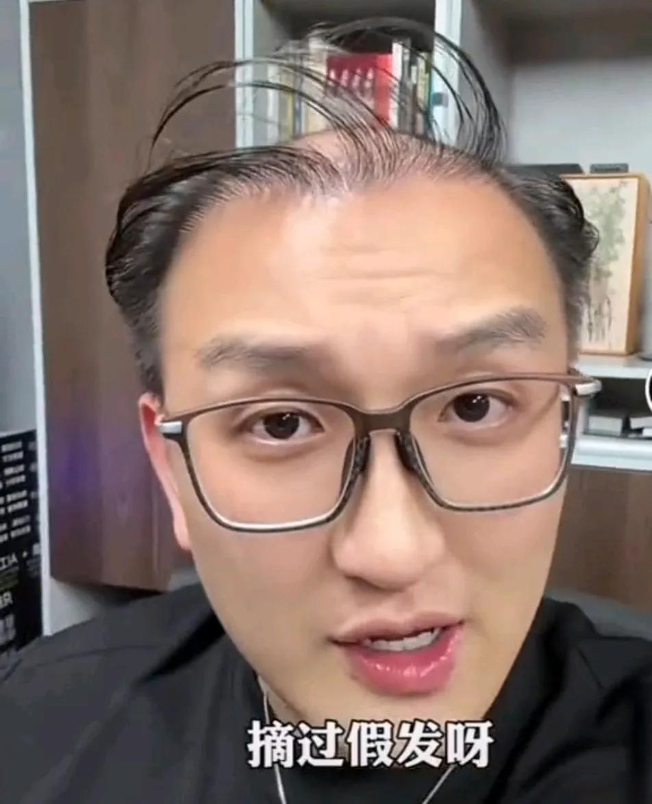 博主妖怪说他不介意自己秃头，还说秃头是智慧的象征。因为他总用脑子，所以才掉发的。