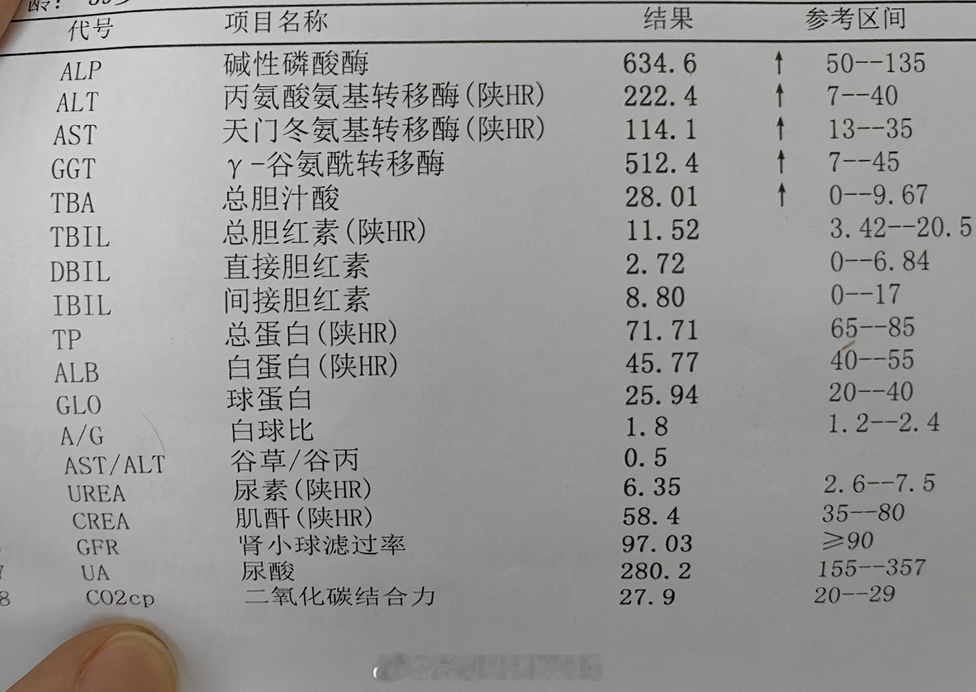 50多岁女性，肝癌术后一年，肿瘤没有任何复发转移的征象。肝功转氨酶等高，问诊了一