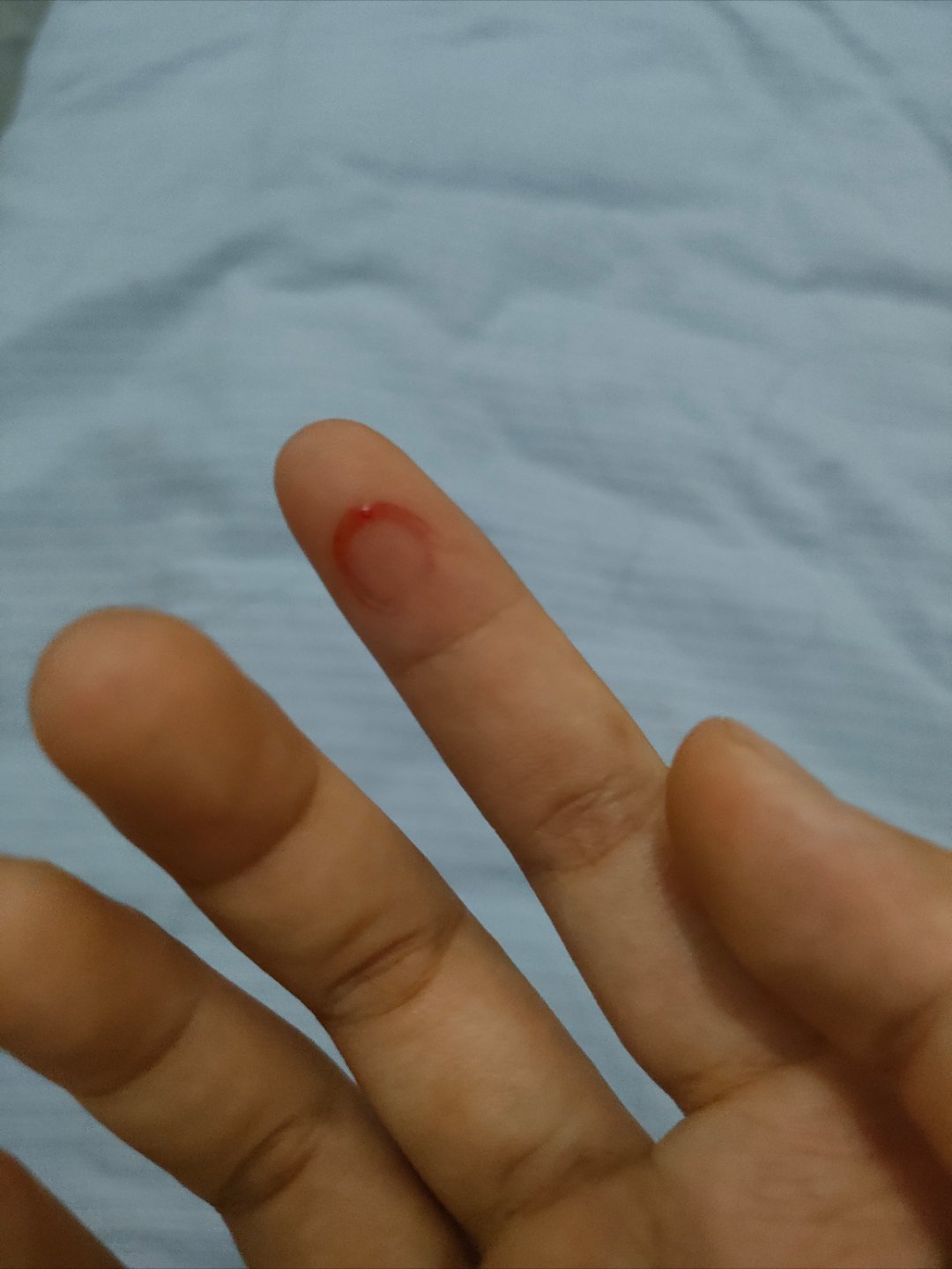 今天怎么这么倒霉 疼死我了 手机膜弄的 