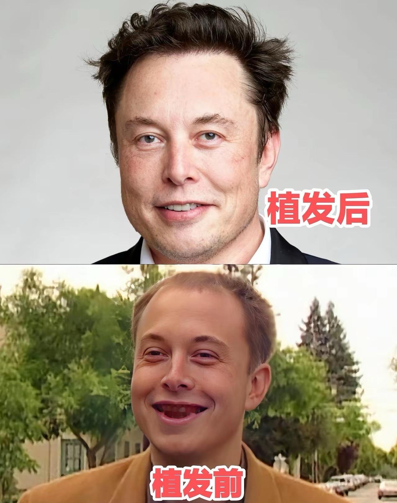 马斯克为几根毛花5万美元植发！男人变美，比女人疯10倍 