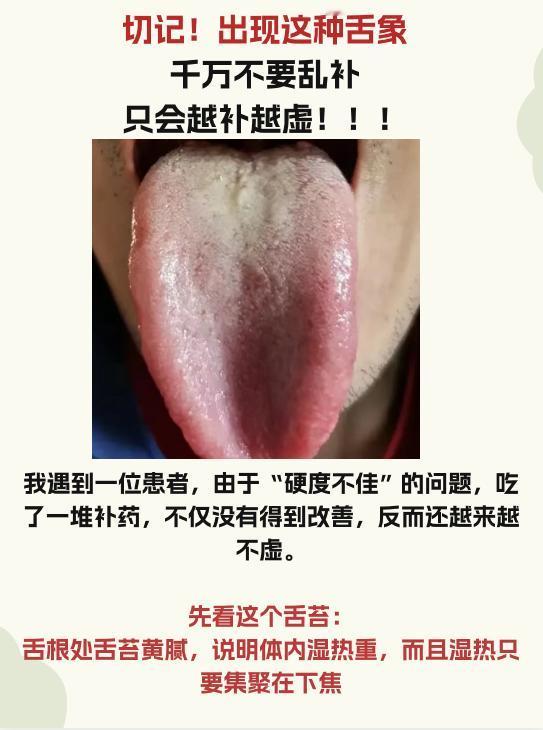 今日舌象分析