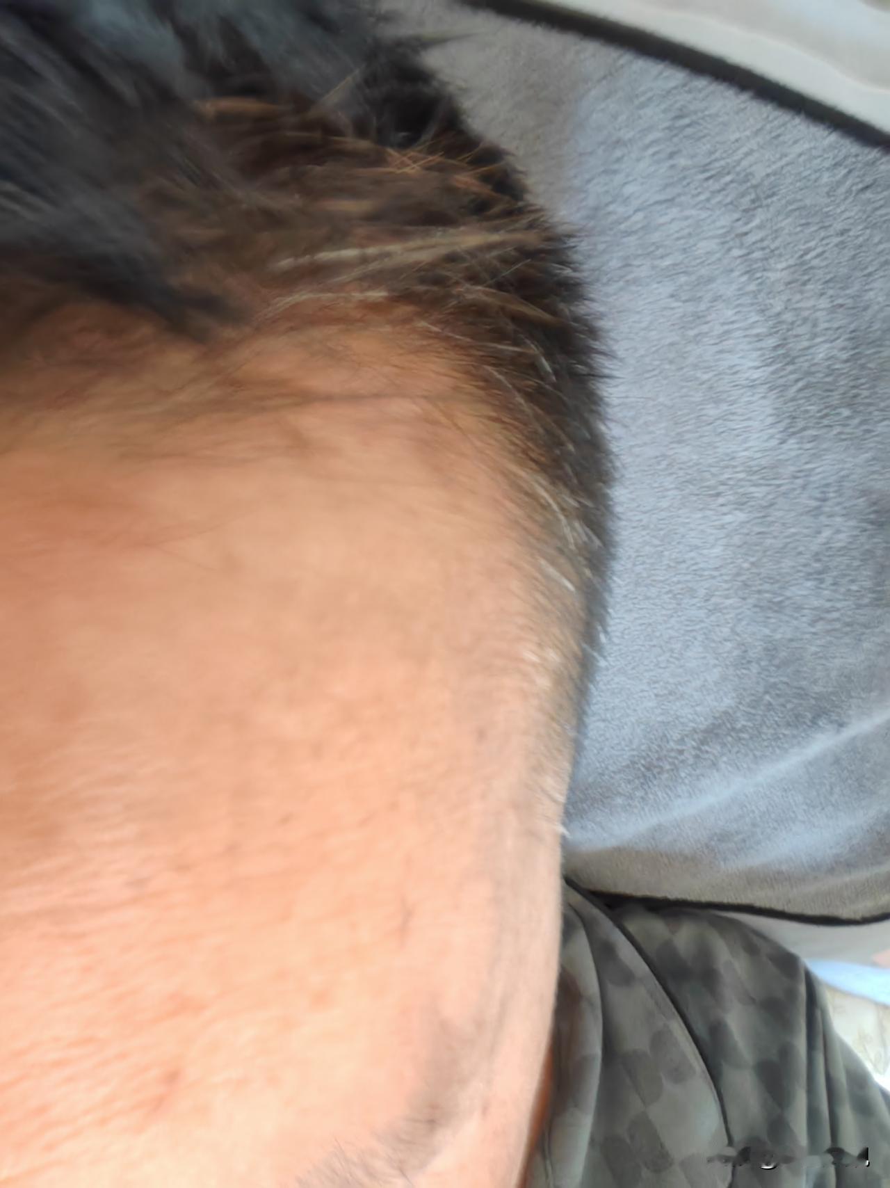 男人63岁确实是个坎，我还有几个月就整63岁了，今年以来身体变化太大了。
   