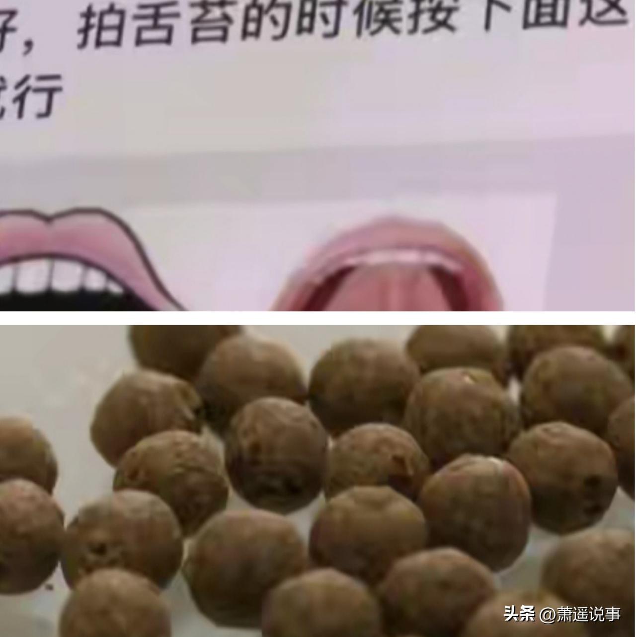 急病乱投医，这下麻烦大了，河南新乡的岳阿姨，为了治疗儿子的精神分裂症，听信根治宣