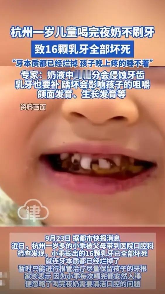 看了这个新闻真的又心疼又着急！才一岁的孩子16颗乳牙全坏死，牙本质都烂了，晚上疼