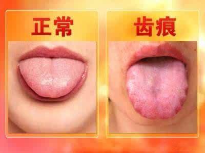中医第一温药“附子理中丸”，让你做回纯爷们附子理中丸，治疗脾肾阳虚的神方。脾阳虚
